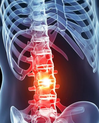 An Epipen for spinal cord injuries (Image Source: medicalhub)