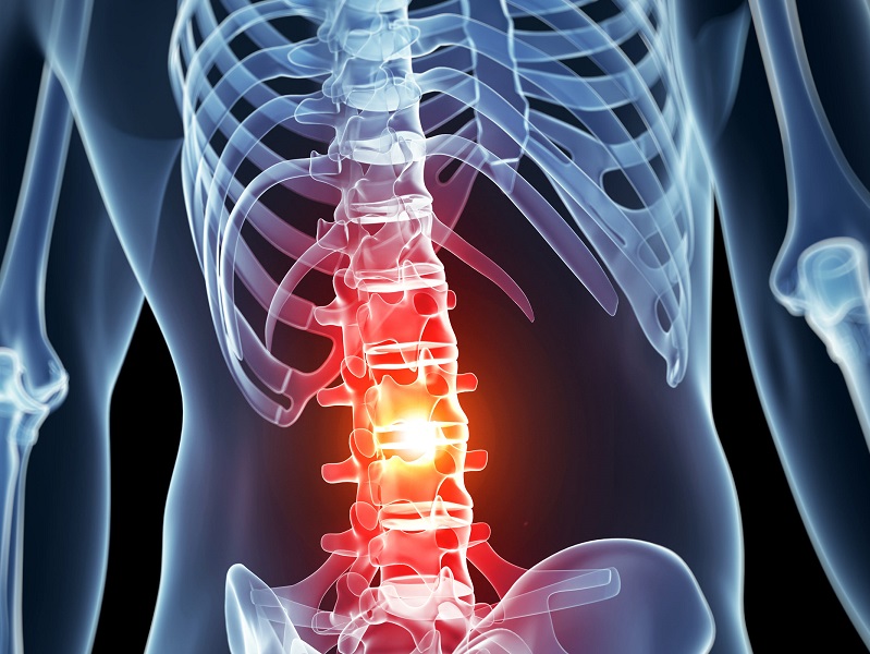 An Epipen for spinal cord injuries (Image Source: medicalhub)